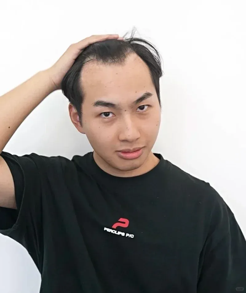 Tuyển tập 100+ ảnh tóc nam ngắn gọn chuẩn phong cách hiện đại · ảnh 3